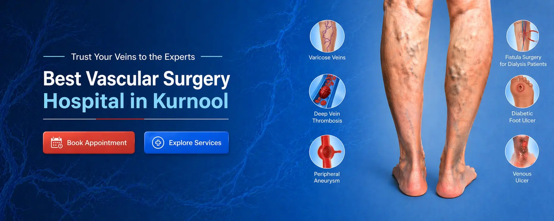 Best Vascular Centre in Kurnool for Varicose Veins Treatment